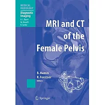 MRI and CT of the Female Pelvis
