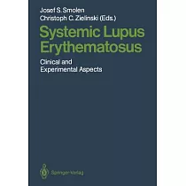 Systemic Lupus Erythematosus： Clinical and Experimental Aspects