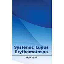 Systemic Lupus Erythematosus