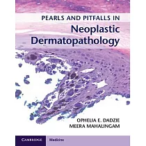 Pearls and Pitfalls in Neoplastic Dermatopathology with Online Access