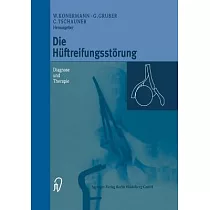 Die Hüftreifungsstörung： Diagnose Und Therapie