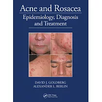 Acne and Rosacea： Epidemiology， Diagnosis and Treatment