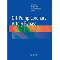 Off Pump Coronary Artery Bypass