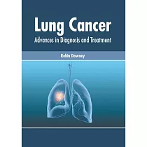 Lung Cancer： Advances in Diagnosis and Treatment
