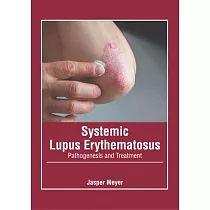 Systemic Lupus Erythematosus： Pathogenesis and Treatment