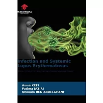 Infection and Systemic Lupus Erythematosus