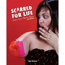 Scarred for Life. 2nd Edition： Every Scar Tells A Story