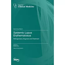 Systemic Lupus Erythematosus： Pathogenesis， Diagnosis and Treatment