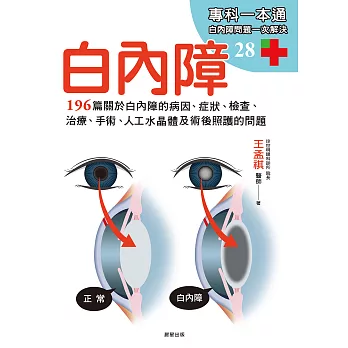 白內障：196篇關於白內障的病因、症狀、檢查、治療、手術、人工水晶體以及術後照護的問題 (電子書)