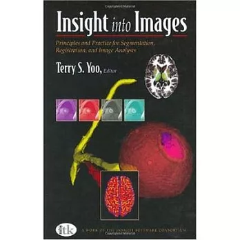 Insight Into Images: Principles and Practice for Segmentation, Registration, and Image Analysis