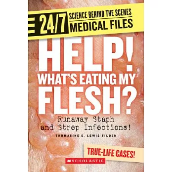 Help! What’s Eating My Flesh?: Runaway Staph and Strep Infections!