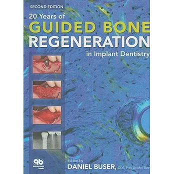 博客來-20 Years of Guided Bone Regeneration in Implant Dentistry