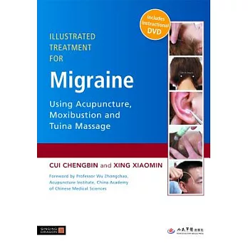 Illustrated Treatment for Migraine Using Acupuncture, Moxibustion and Tuina Massage: Treated With Acupuncture, Moxibustion and T