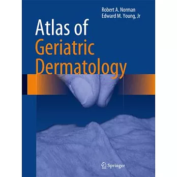 Atlas of Geriatric Dermatology