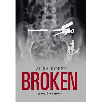 Broken: A Mother’s Story