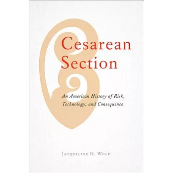 Cesarean Section: An American History of Risk, Technology, and Consequence