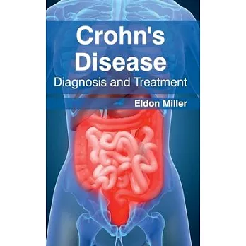 Crohn’’s Disease: Diagnosis and Treatment