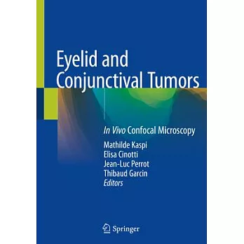 Eyelid and Conjunctival Tumors: In Vivo Confocal Microscopy