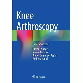 Knee Arthroscopy: How to Succeed