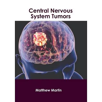 Central Nervous System Tumors