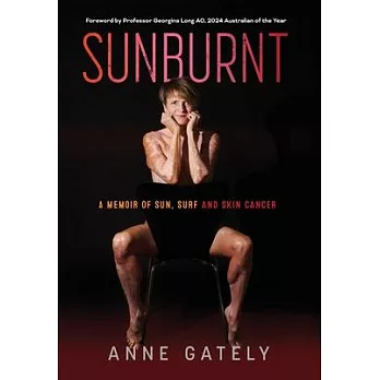 Sunburnt: A memoir of sun, surf and skin cancer