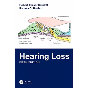 Hearing Loss