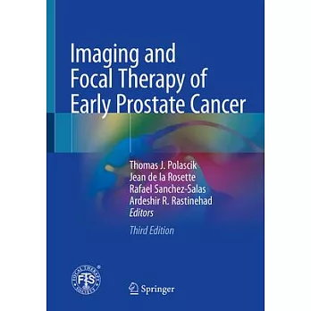 Imaging and Focal Therapy of Early Prostate Cancer