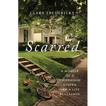 Scarred: A Memoir of a Childhood Stolen and a Life Reclaimed