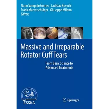 Rotator Cuff Injury Explained. Including Rotator Cuff Tear, Rotator Cuff  Bursitis, Rotator Cuff Tendonitis. Symptoms, Exercises, Stretches, Repair,  Re