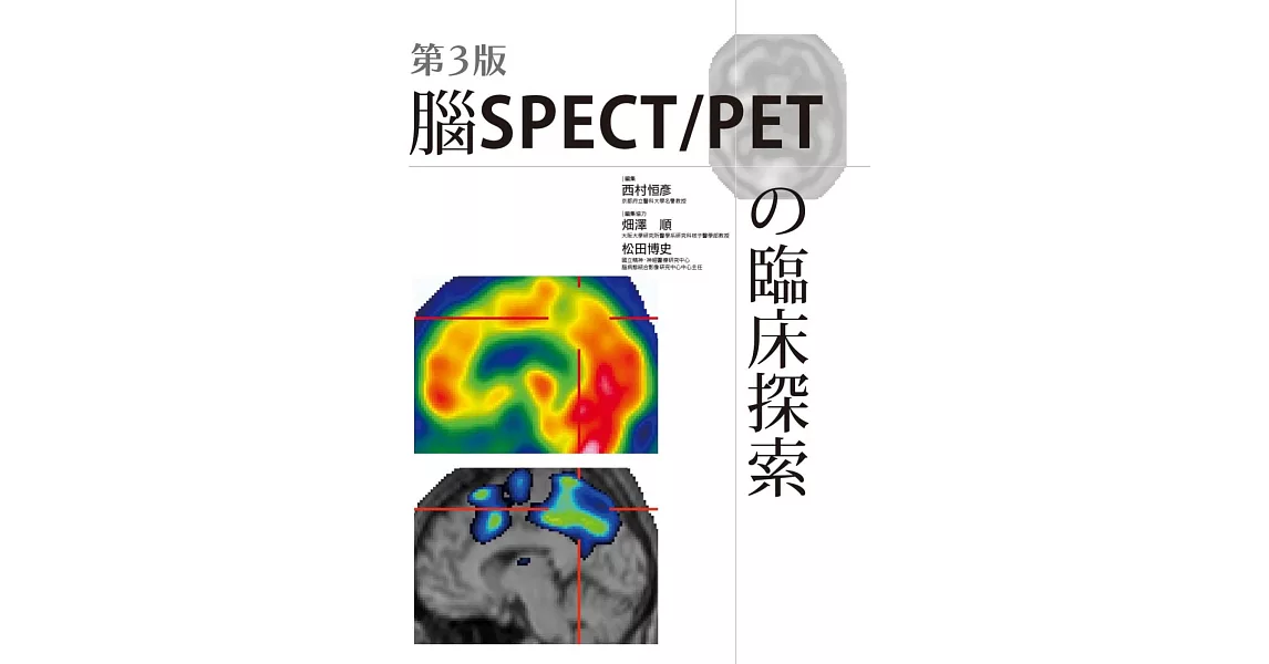 腦SPECT/PETの臨床探索(第3版) | 拾書所