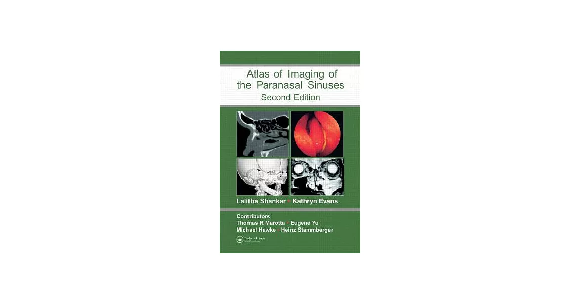 An Atlas of Imaging of the Paranasal Sinuses | 拾書所