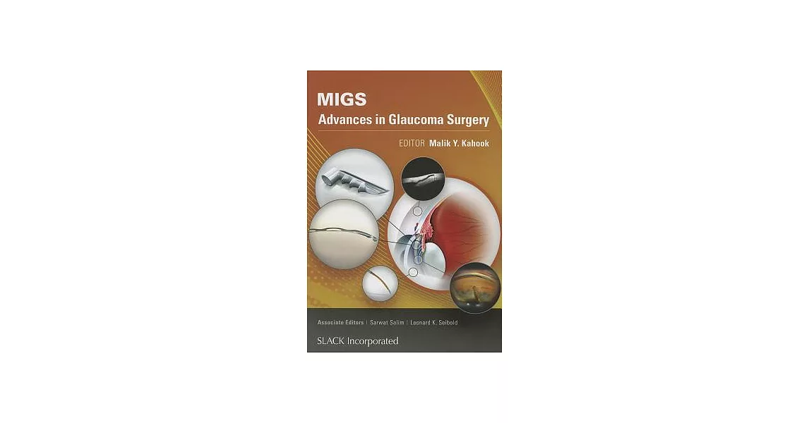 Migs: Advances in Glaucoma Surgery | 拾書所