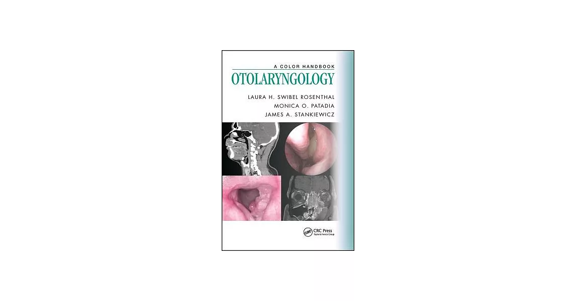 Otolaryngology: A Color Handbook | 拾書所