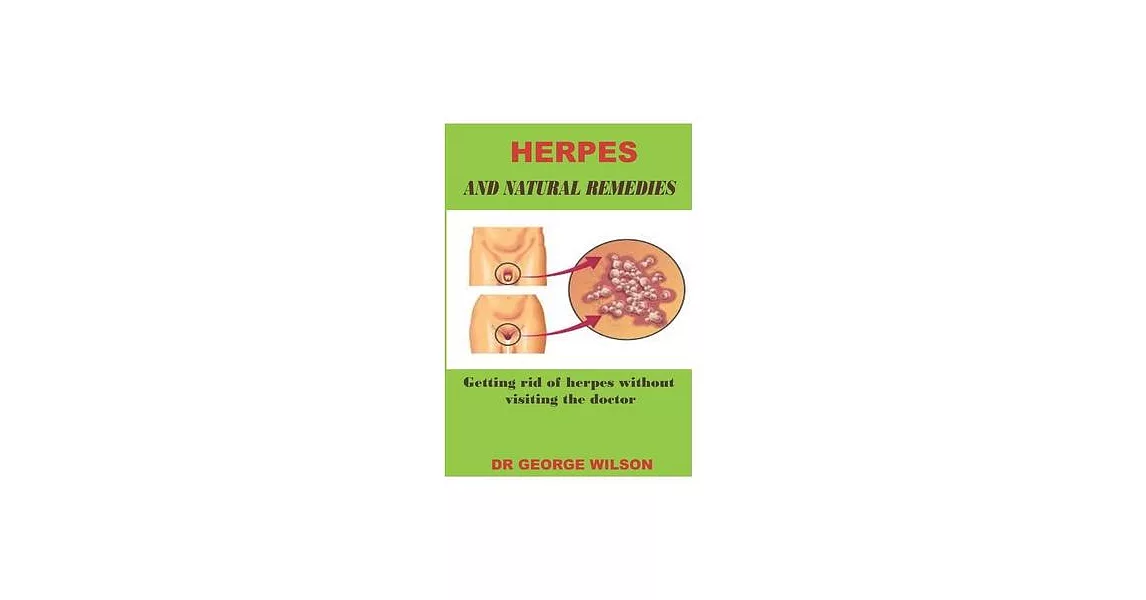 Herpes and Natural Remedies: Getting rid of herpes without visiting the doctor | 拾書所