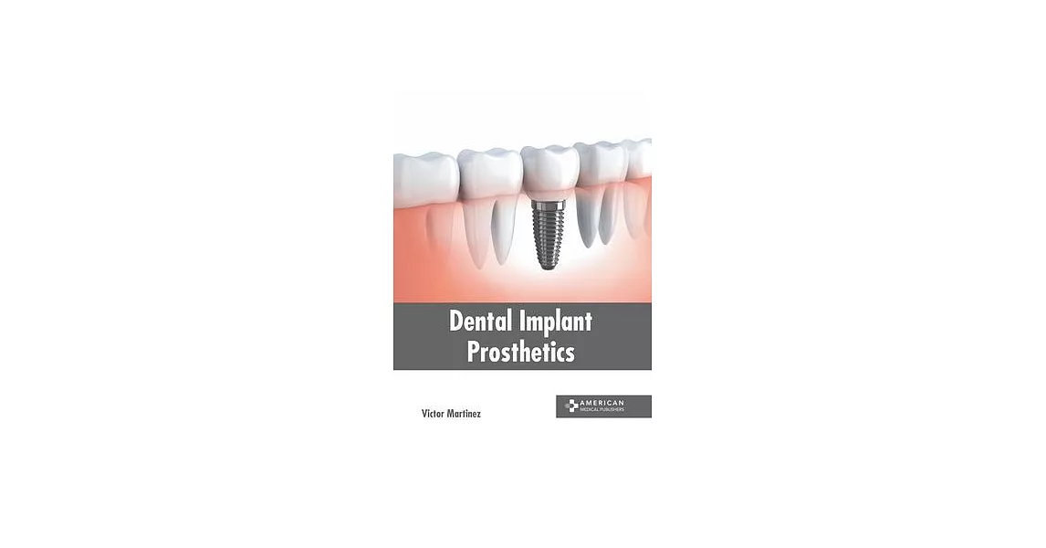 Dental Implant Prosthetics | 拾書所