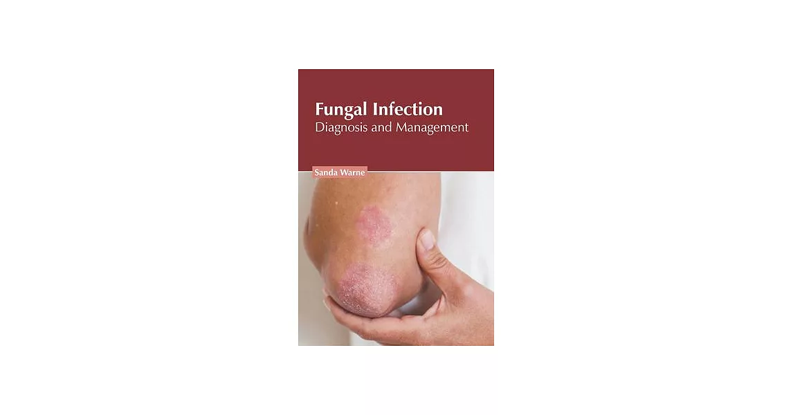 Fungal Infection: Diagnosis and Management | 拾書所