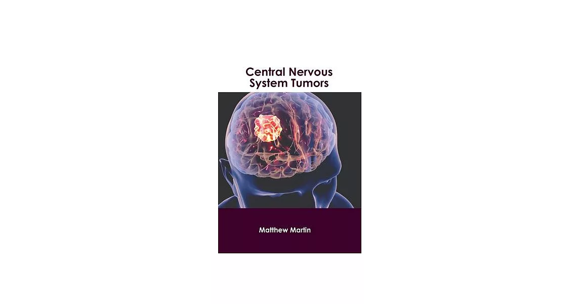 Central Nervous System Tumors | 拾書所