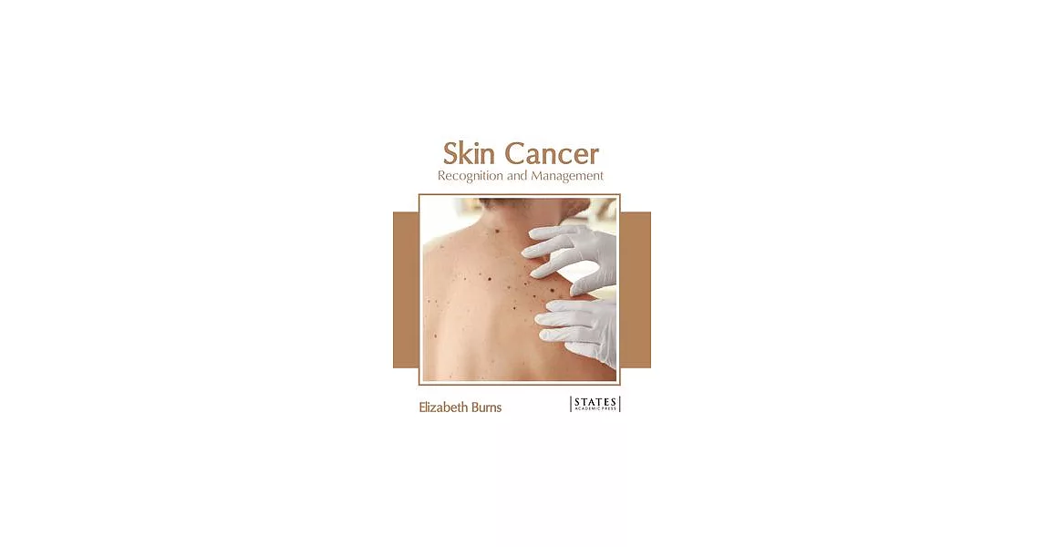 Skin Cancer: Recognition and Management | 拾書所
