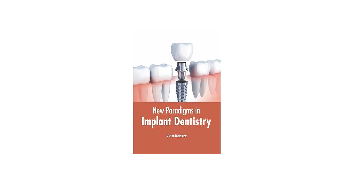 New Paradigms in Implant Dentistry | 拾書所