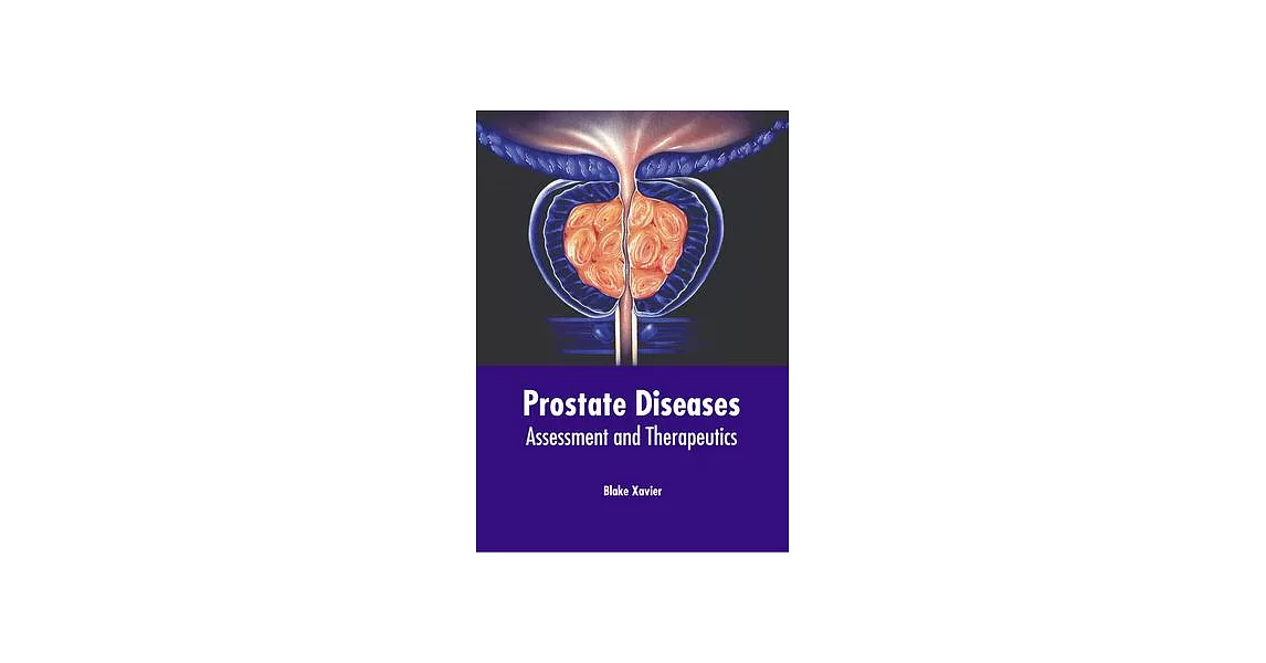 Prostate Diseases: Assessment and Therapeutics | 拾書所