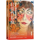 紅斑性狼瘡:診斷治療與照護指南