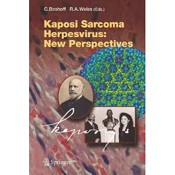 Kaposi Sarcoma Herpesvirus