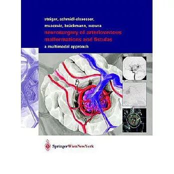 Neurosurgery of Arteriovenous Malformations and Fistulas: A Multimodal Approach