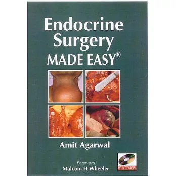Endocrine Surgery Made Easy