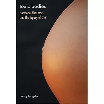 Toxic Bodies: Hormone Disruptors and the Legacy of DES