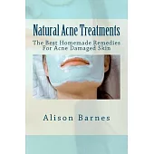 Natural Acne Treatments