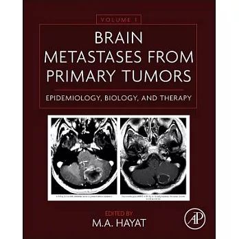 Brain Metastases from Primary Tumors: Epidemiology, Biology, and Therapy