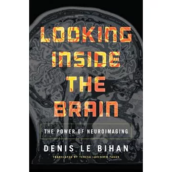 Looking Inside the Brain: The Power of Neuroimaging