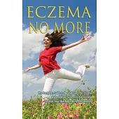 Eczema No More: The Complete Guide to Natural Cures for Eczema and a Holistic System to End Eczema & Clear Your Skin Naturally &