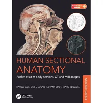 Human Sectional Anatomy: Pocket Atlas of Body Sections, CT and MRI Images, Fourth Edition